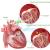 Мітральна недостатність серця: причини, прояви та лікування