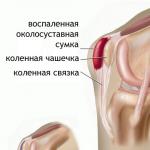 Liječenje zglobova mumijo Šta pomaže kod bolova u koljenu