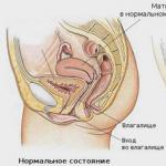 Опущение матки: симптомы, причины, лечение